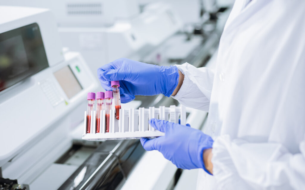 Scientist wear glove holding test tube in sample rack to check q